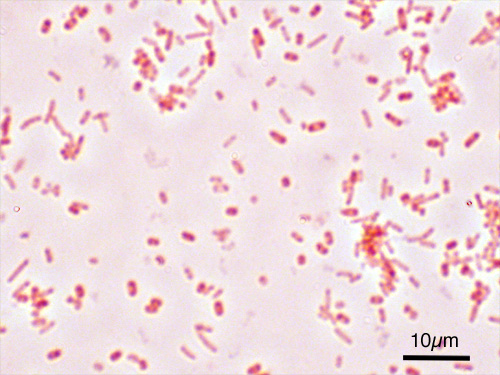Image microscopique de "Salmonella enterica", gastro-entérite. Photo : Y tambe, 2005/7/6