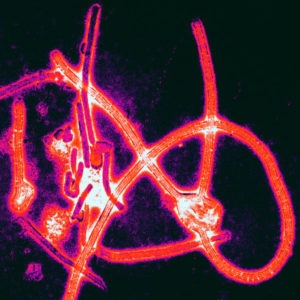 Des particules du virus Ebola (source : Thomas W. Geisbert, École de médecine de l'université de Boston)